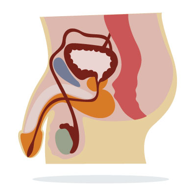 benign-prostatic-hyperplasia-bph-prostate-hyperplasia