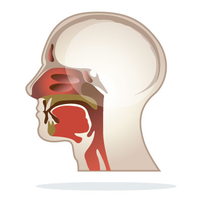 canker-sore-aphthous-ulcer