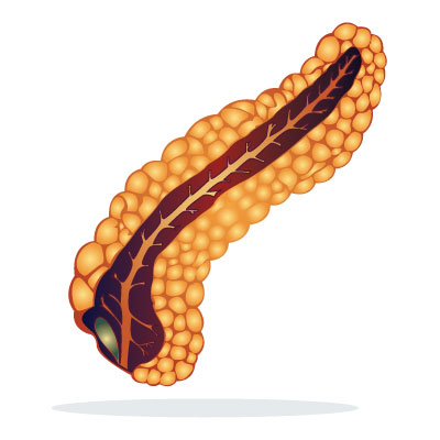 dmii-diabetes-mellitus-type-2