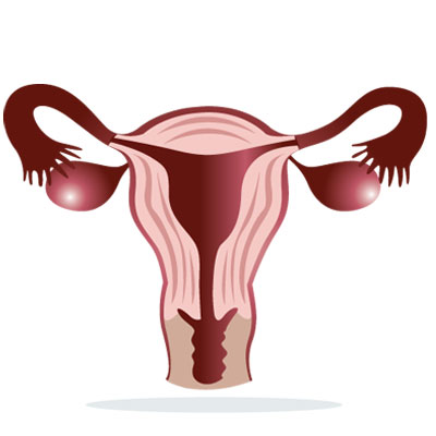 gestational-hypertension-preeclampsia