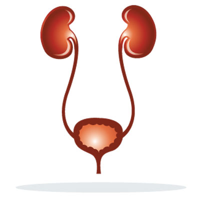 kidney-stones-nephrolithiasis