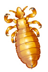 pediculosis-lice-louse